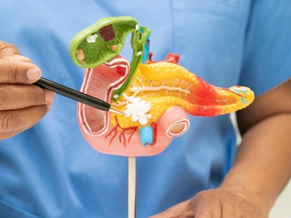 Pankreas Kisti Nedir? Belirtileri, Çeşitleri, Takibi